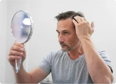 Hair Loss Treatment